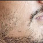 Patchy Beard Solutions